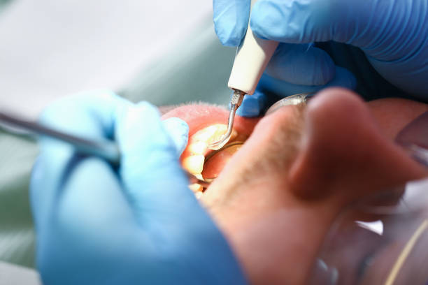  Sunset, LA Emergency Dentist Pros