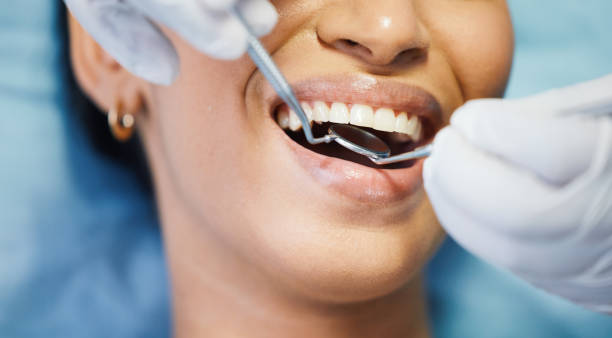 Best Teeth Whitening  in Sunset, LA